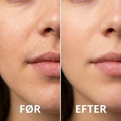 Hårborttagningsolie – Naturligt Glat Og Hårfri